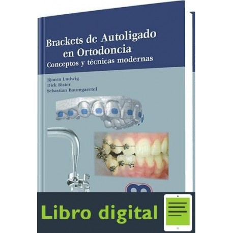 Brackets De Autoligado En Ortodoncia Conceptos y Tecnicas Modernas