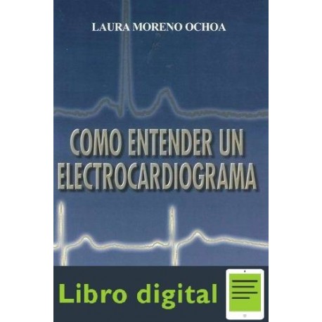 Como Entender Un Electrocardiograma Laura Moreno Ochoa