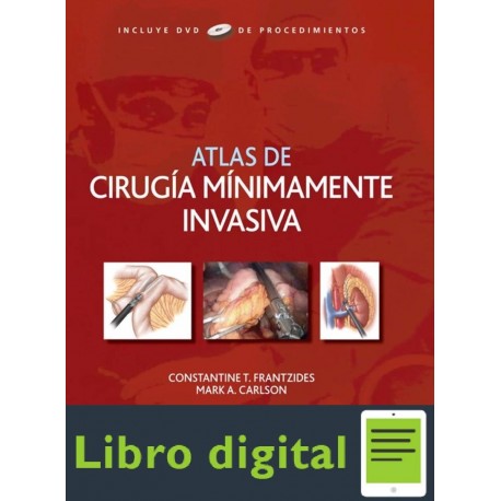 Atlas De Cirugia Minimamente Invasiva