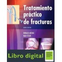 Tratamiento Practico De Fracturas R. Mcrae