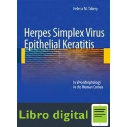 Herpes Simplex Virus Epithelial Keratitis Tabery