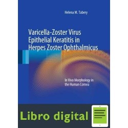 Varicella Zoster Virus Epithelial Keratitis In Herpes Zost