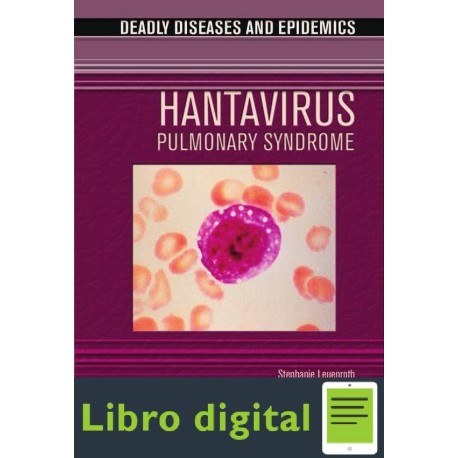 Hantavirus Pulmonary Syndrome Leuenroth