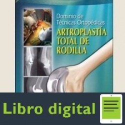 Dominio de Tecnicas Ortopedicas Artroplastia Total de Rodilla