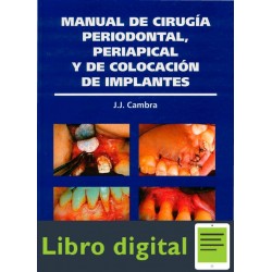 Cirugia Periodontal Y Colocacion De Implantes