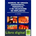 Cirugia Periodontal Y Colocacion De Implantes