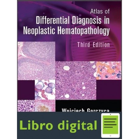 Atlas Of Differential Diagnosis In Neoplastic Hemato