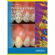 Periodontologia Clinica E Implantologia Odontologica 6 edicion Tomo 1